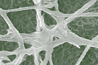 Bone Under Electron Microscope
