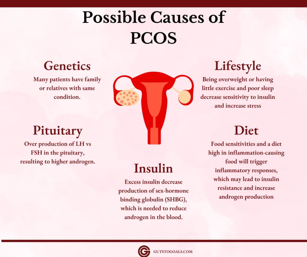 Infographics Causes of PCOS Manage PCOS by Identifying the Factors that Caused its Symptoms